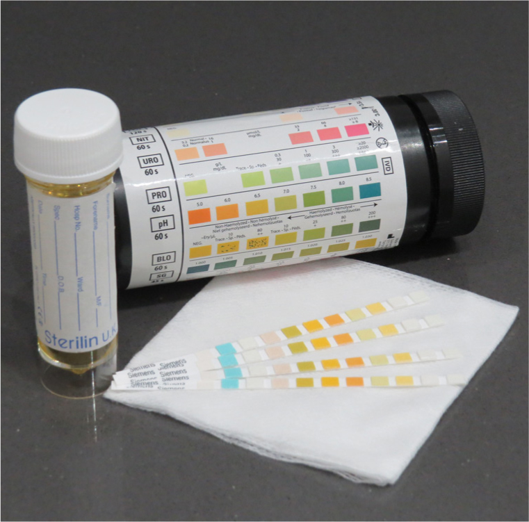 Urinalysis Strips 10A in Kenya